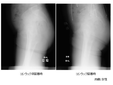 73歳女性