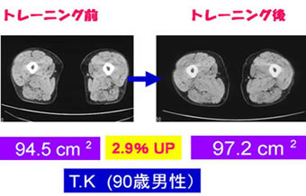 「シニアエクササイズ」実施後の大腿部筋横断面積の変化